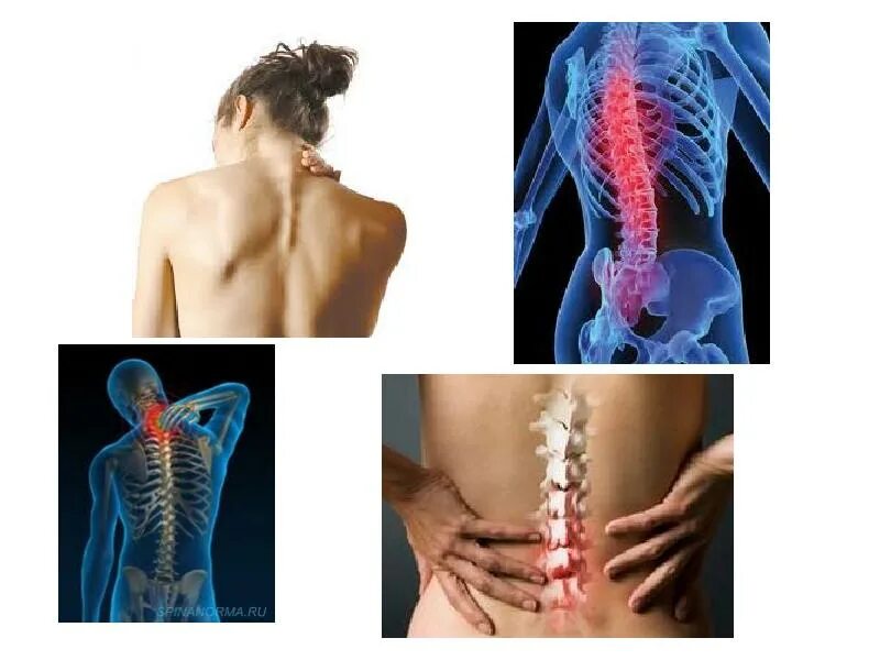 Заболевания связанные с опорно двигательной системой. Заболевания связанные с опорно двигательной системой. Опорно двигательный аппарат. Заболевания аппорнодвигательного аппарата. Что такое нарушения опорнодвигательногй системы.