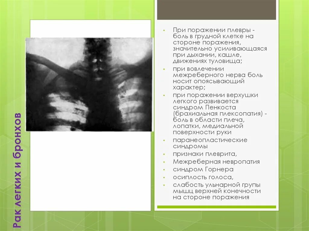 Больно дышать слева. Болит в грудине при вдохе. При вдохе болит грудная клетка справа. Болит справа в грудине при вдохе.