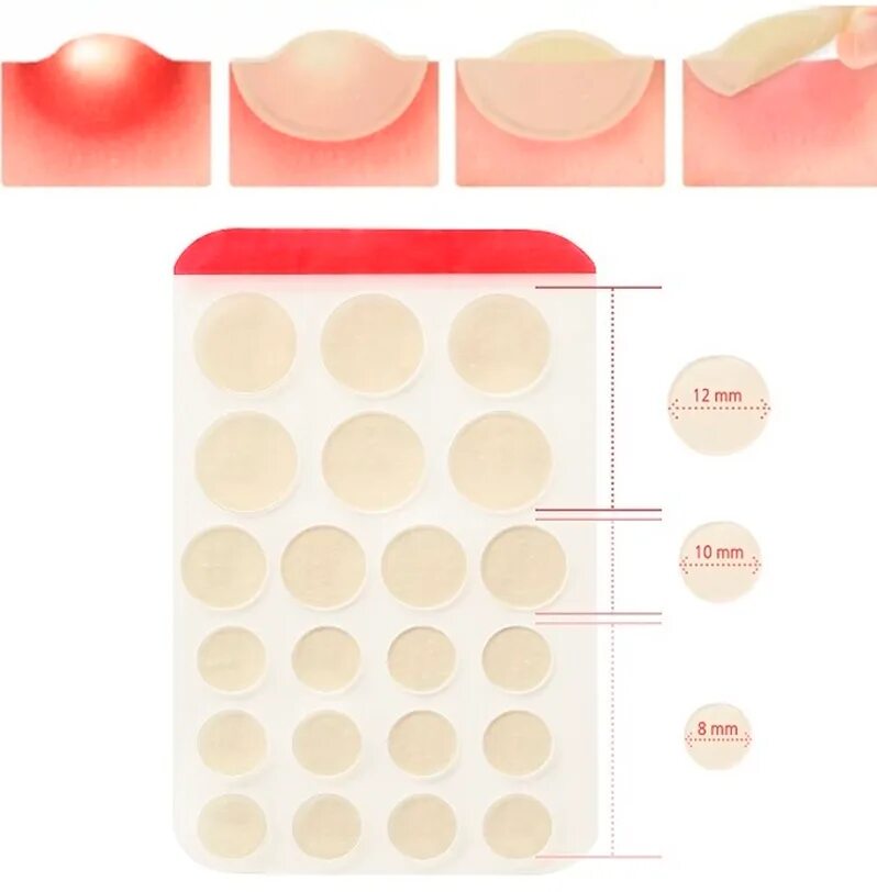 Патчи от прыщей elizavecca blemish spot patch 44 шт. Пластырь от прыщей. Патчи от акне точечные elizavecca witch piggy hell pore blemish spot patch, 44шт. Пластырь для лица от прыщей. Лейкопластырь от прыщей на лице.