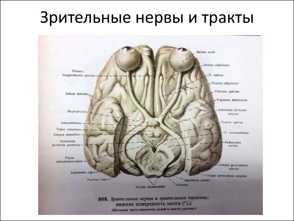 Зрительный нерв хиазма зрительный тракт. Зрительный нерв ,хиазма анатомия. Перекрест зрительного тракта анатомия. Зрительный путь головной мозг вид снизу. Два зрительных нерва