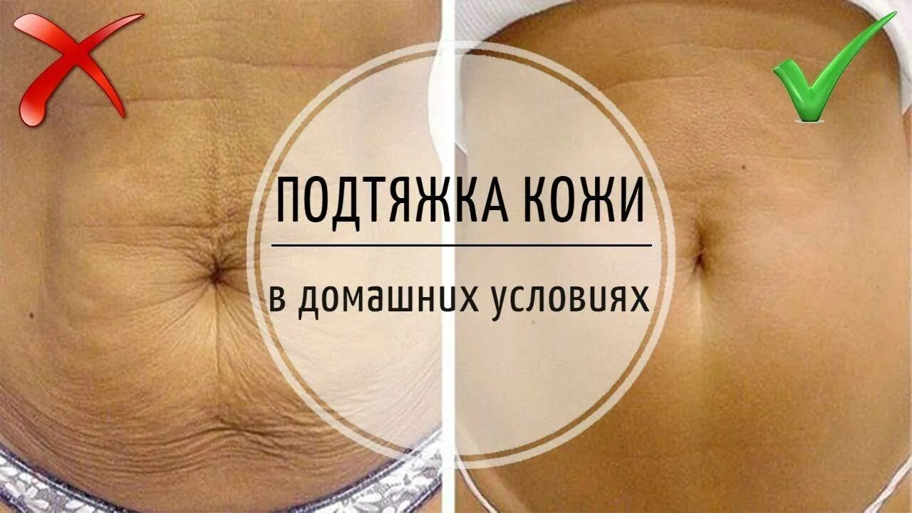 Как подтянуть живот после. Крем для живота от дряблости.
