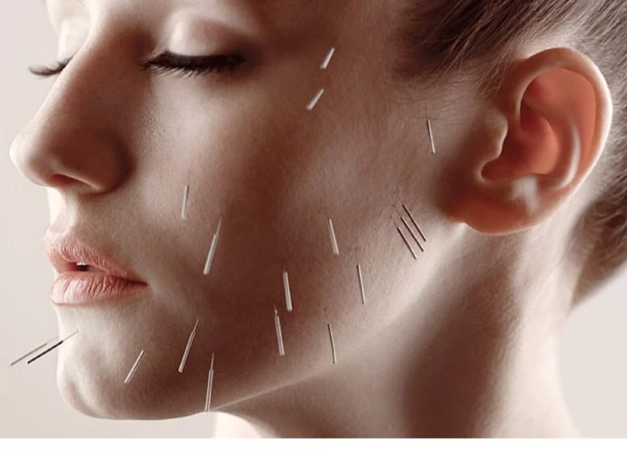 Иглы в лицо. Акупунктурный лифтинг лица. Пинхед восставший из ада. Иглы в лицо. Иголки на лицо для омоложения.