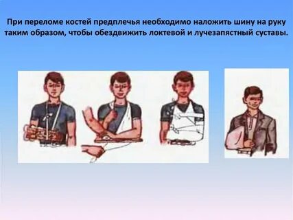 При повреждении костей предплечья