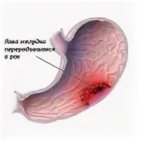 Как вылечить желудок форум
