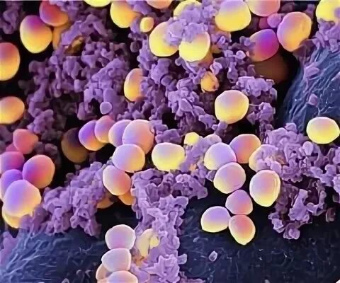 Микроорганизм staphylococcus aureus. Стафилококки и стрептококки микробиология отличие. staph. epidermidis. st aureus.