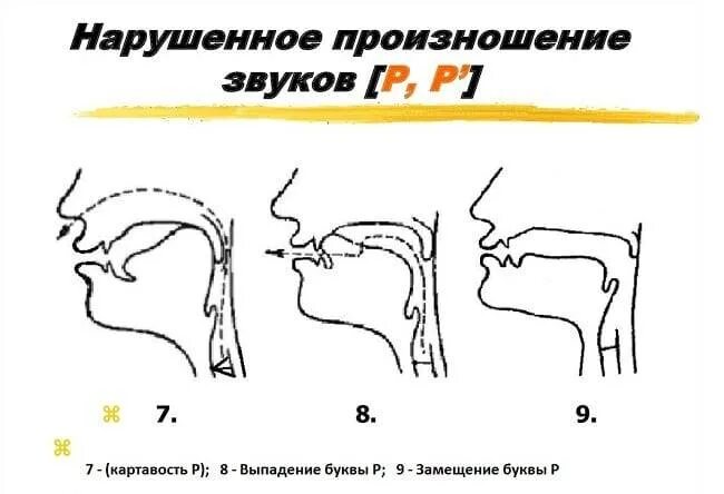Как научиться говорить букву р взрослому. Упражнения для буквы р взрослому. как говорить букву р. как научиться выговаривать букву р. упражнения на картавость буква р.