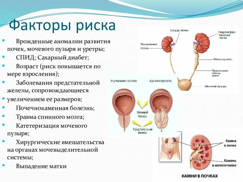 Заболевания почек и мочевого пузыря. Факторы способствующие развитию мочекаменной болезни. Факторы риска возникновения пиелонефрита. Факторы риска развития мочекаменной болезни. Факторы риска развития острого пиелонефрита.