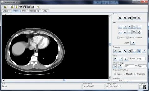 Vidar dicom viewer