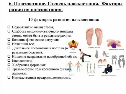 Плоскостопие причины возникновения москва