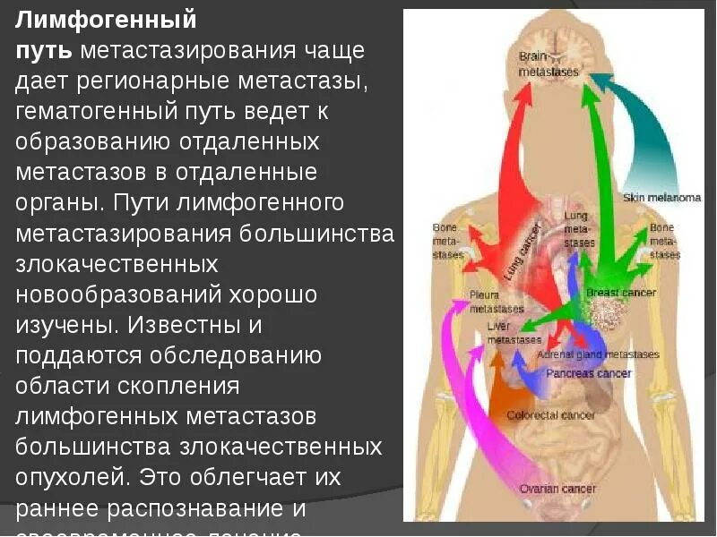Регионарные метастазы при раке