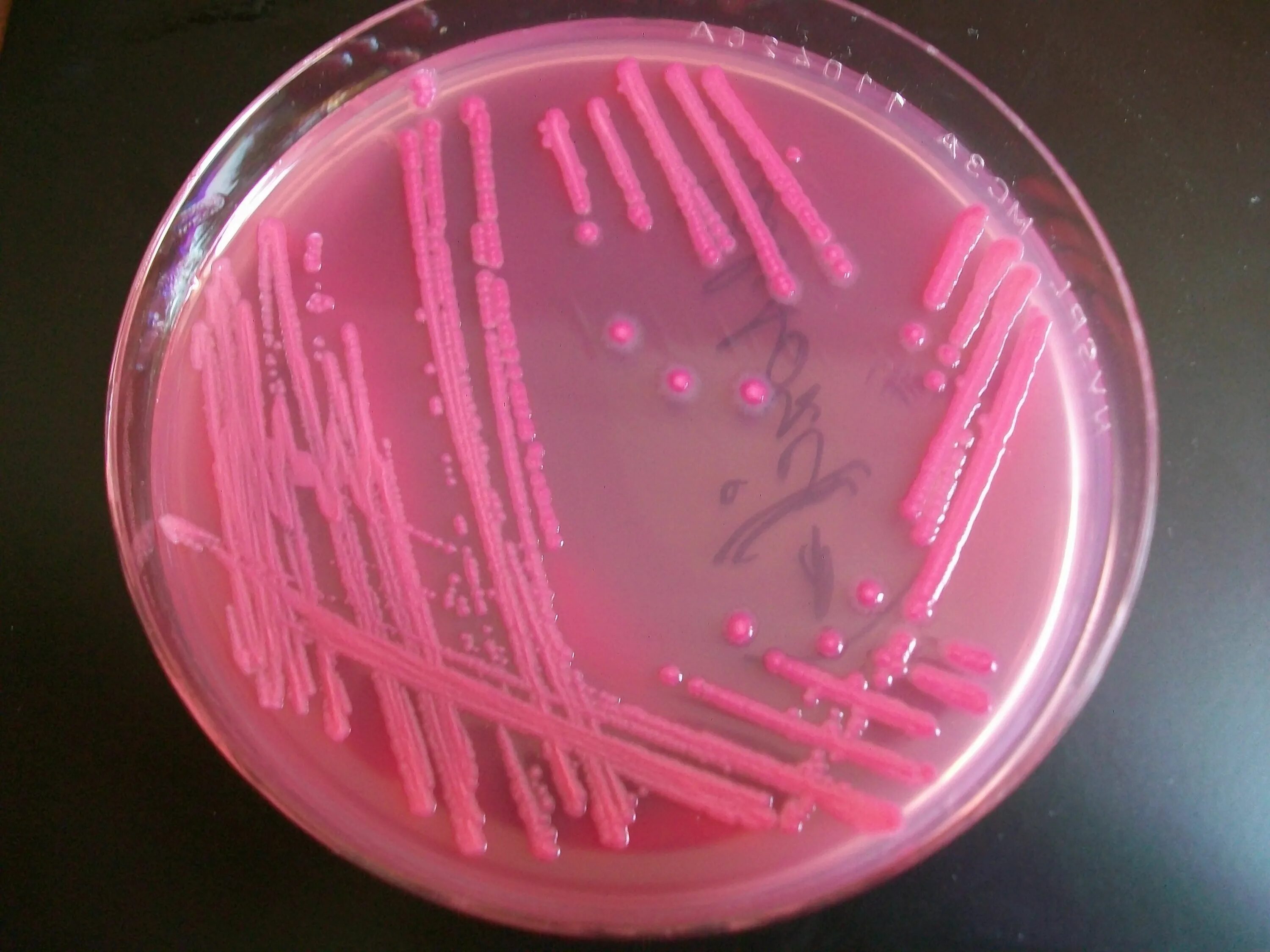 E. coli на агар МАККОНКИ. Pseudomonas aeruginosa на чашке Петри. Шигелла на среде Эндо. Кишечная палочка на среде Эндо. Посев на сальмонеллез