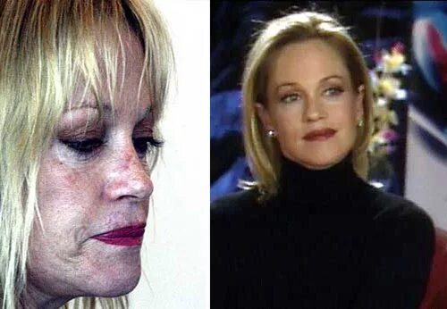 элеонора кондратюк и рубен григорян. элеонора кондратюк и рубен григорян. элеонора кондратюк сейчас. мисс сочи элеонора кондратюк. элеонора кондратюк облили кислотой.