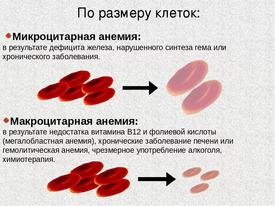 Анемия стул. Эритроциты при макроцитарной анемии. Анемия железодефицитная эритроциты в крови. Симптомы микроцитарной анемии. Эритроциты при снижении гемоглобина.