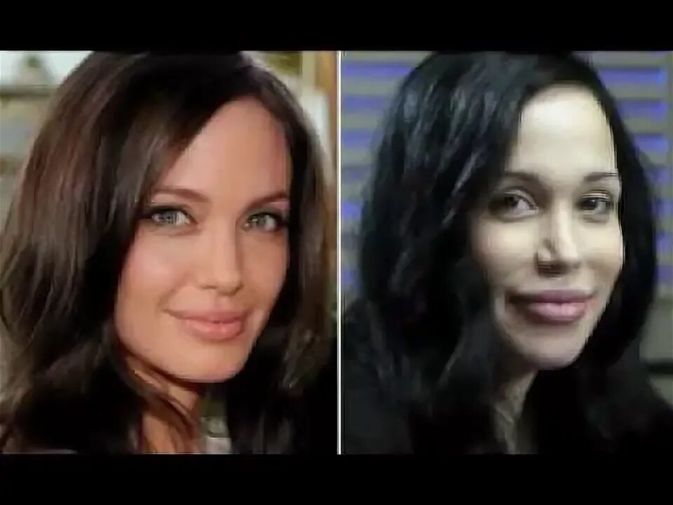 Анджелина до и после пластики Real Face Of the 22 year-old Girl Who Really undergo 50 Plastic Surgeries To Loo
