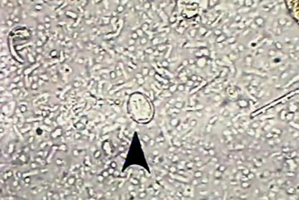 Ascaris Lumbricoides Microscope DD7