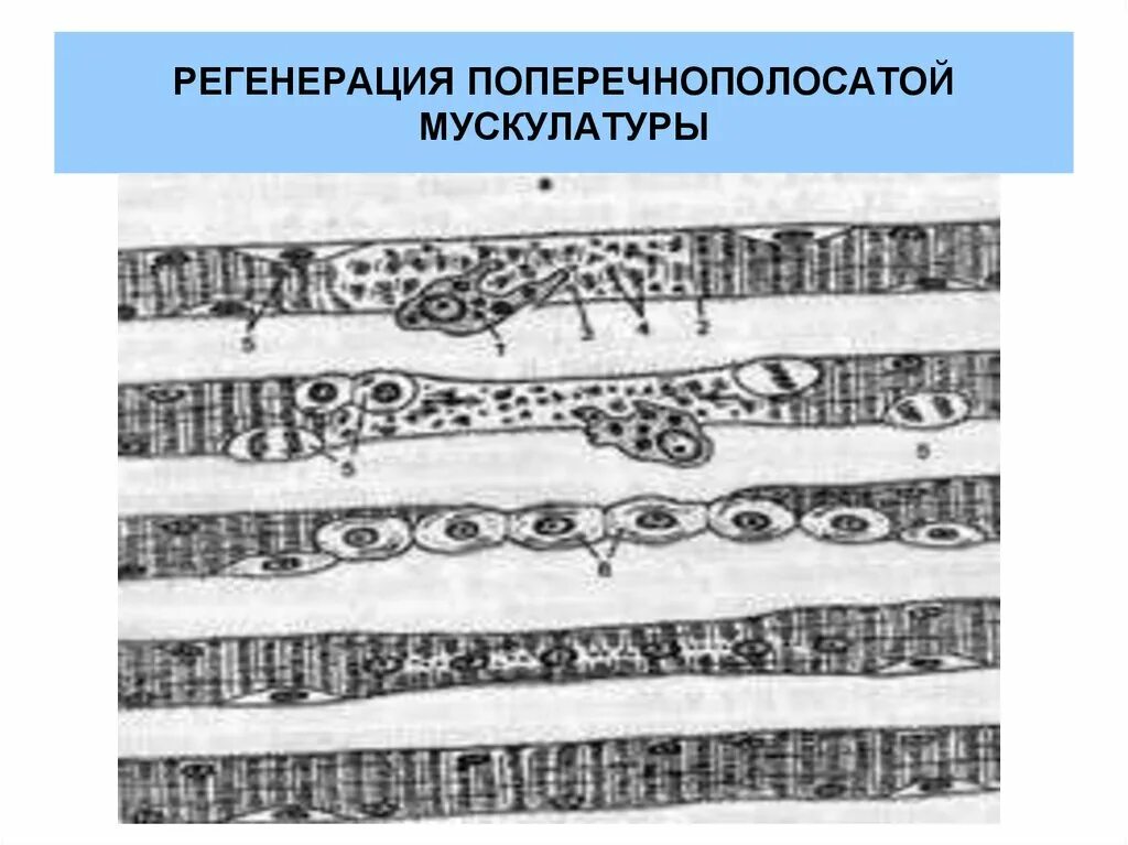 Гистогенез мышечной ткани. Регенерация поперечно полосатой скелетной мышечной ткани. гистогенез мышечной ткани гистология. регенерация сердечной поперечнополосатой мышечной ткани. регенерация скелетной мышечной ткани гистология.