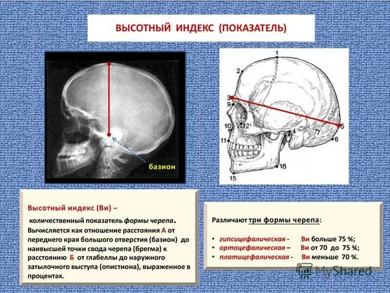 Свод точка. Краниометрические показатели черепа. Основные краниометрические точки мозгового черепа. Измерение размеров черепа. Нормальный размер черепа у человека.
