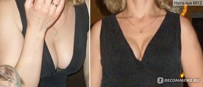Грудь до и после ребенка Wholesale Inyección de relleno dérmico Allurlane 20 ml aumento de glúteos con je