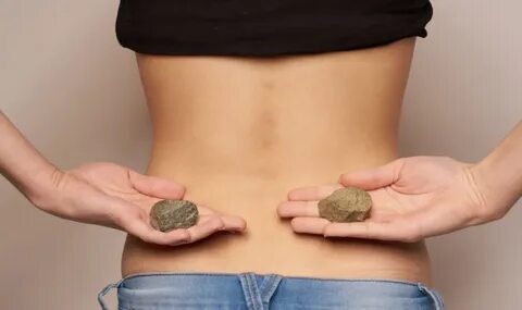 Уролог Топузов объяснил, как избежать образования камней в почках Здоровье Селдо