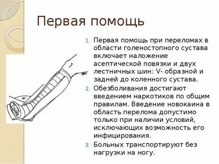 Перелом голеностопного сустава иммобилизация