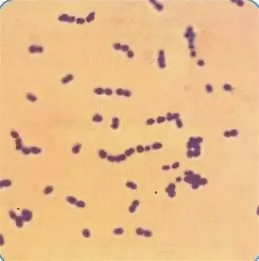 Peptostreptococcus spp. Peptostreptococcus anaerobius по граму. пептострептококки окраска по граму. peptostreptococcus anaerobius 17642 что это. пептококки микробиология.