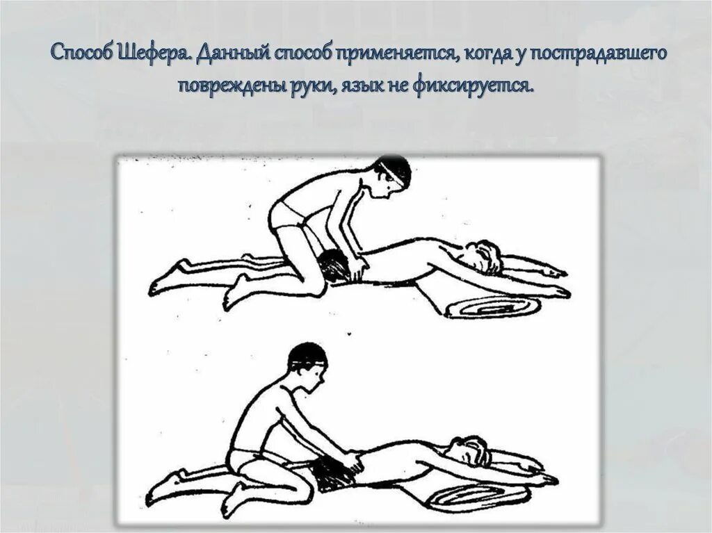 Данный способ используется в. Способ шефера. способы прикладного плавания. прикладное плавание презентация. способ каллистова.