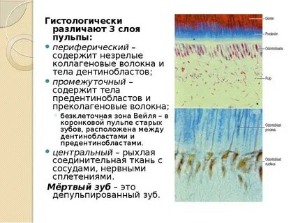 Волокна пульпы