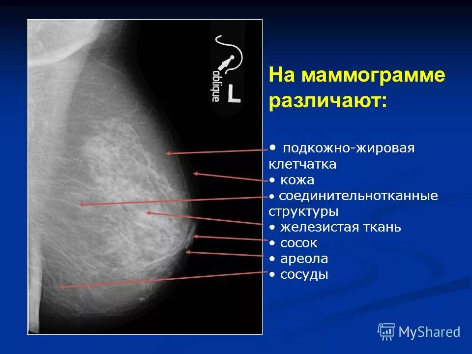 Центр маммограммы