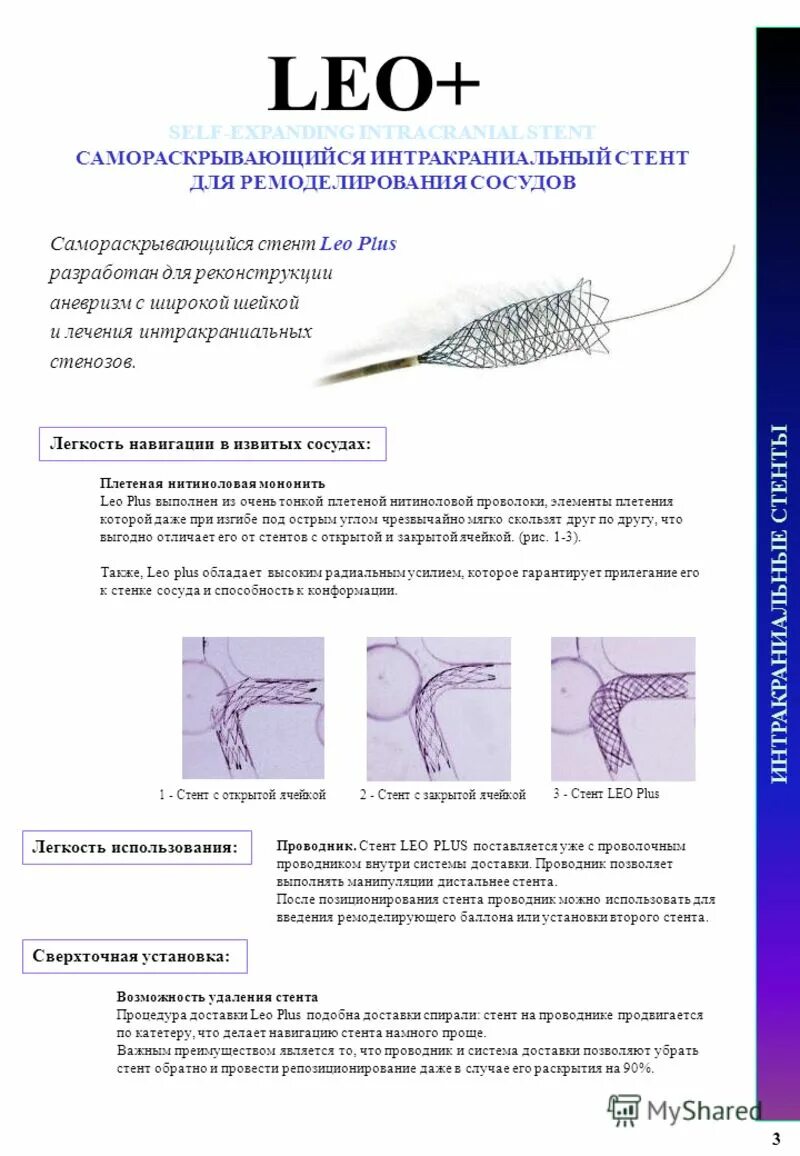 Система доставки стенты. Коронарный стент Калипсо. Самораскрывающийся Нитиноловый стент. Интракраниальные стенты.