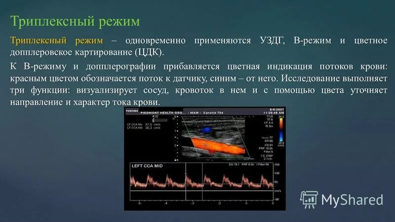 размеры лимфатических узлов в норме у взрослых. трансабдоминальный метод узи это. принцип работы ультразвуковой диагностики. узи с цветовым допплеровским картированием. узи с цветовым допплеровским картированием.