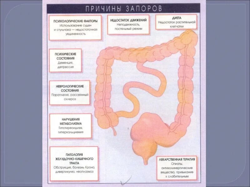 Почему запоры что делать. Причины запора. Психологический запор. Психологические причины запоров. Причины запора у женщины.