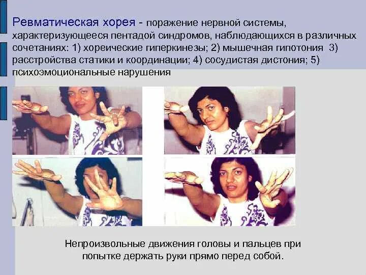 Мало поражении