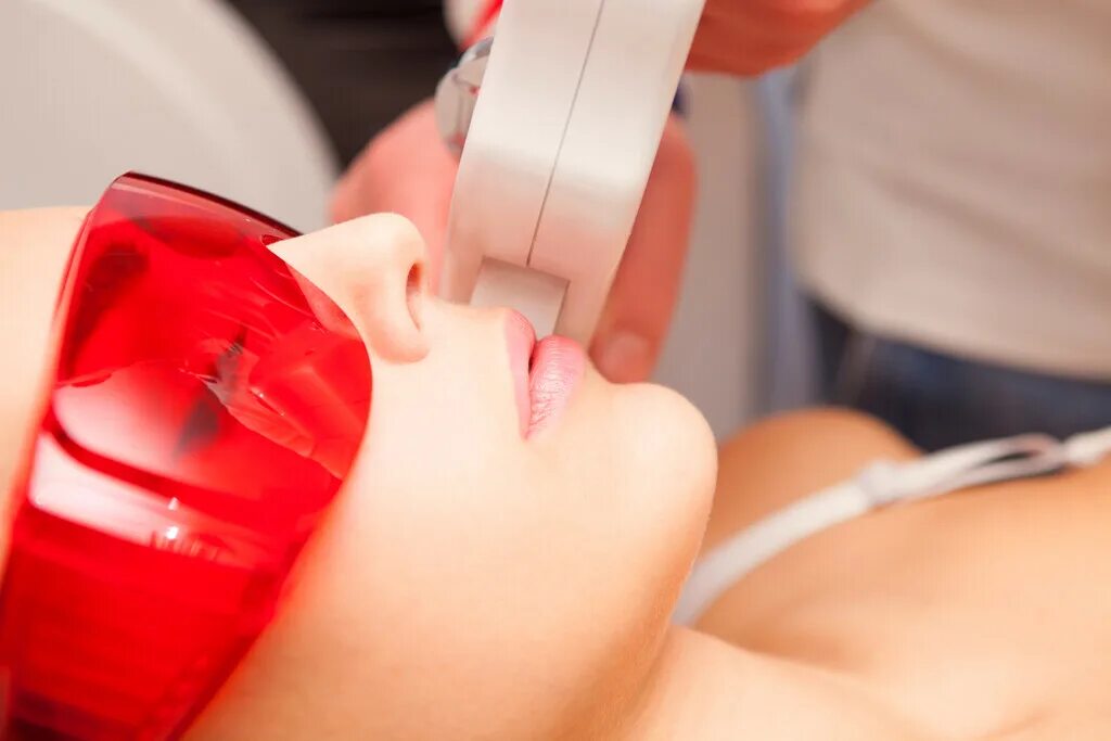 Joli laser. Лазерная эпиляция. Лазерный луч для фотошопа. Joli laser. Луч лазера.