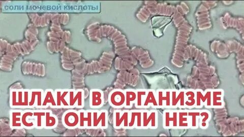 Шлаки в организме