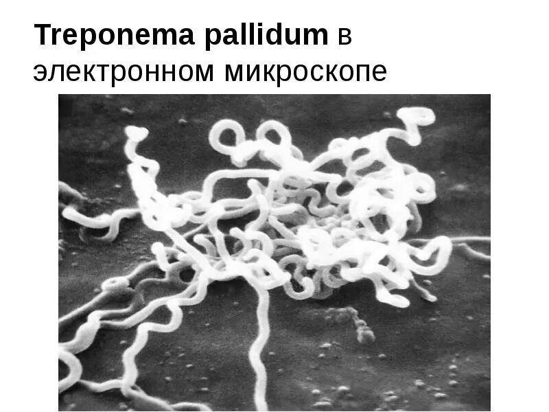 1 treponema pallidum. Бледная трепонема (treponema pallidum). трепонема микроскопия. бледная трепонема в микроскопе. строение бледной трепонемы микробиология.