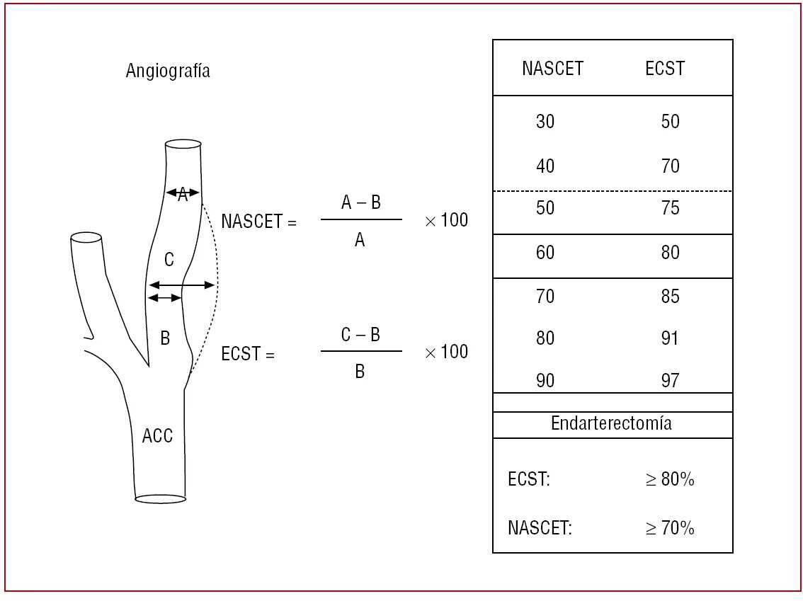 Степень стеноза по nascet. Измерение степени стеноза по nascet. Материал исследования критерии включения. Nascet и ecst. Ecst стеноз.