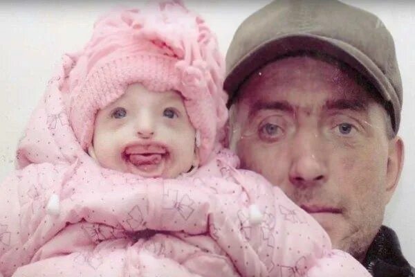 Как сейчас выглядит девочка дарина Рожденные без мозга / Научный интерес № 2 YouTube