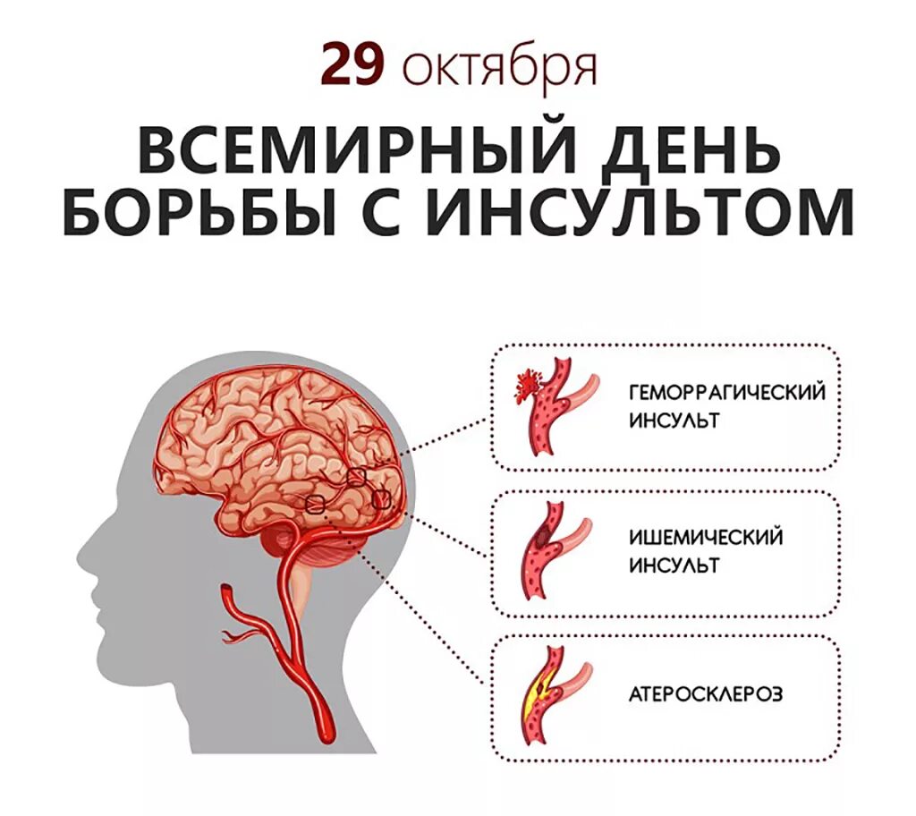 Инсульт 3 месяца. Инсульт. День инсульта. Борьба с инсультом. 29 Октября Всемирный день инсульта.