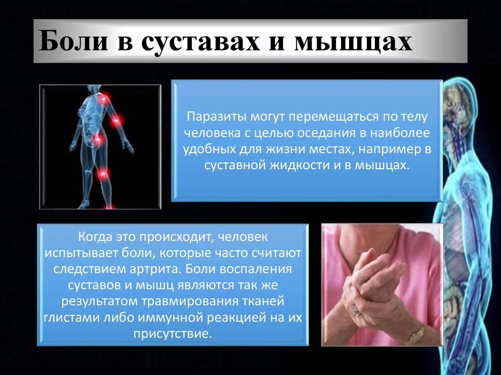 Грипп болят мышцы