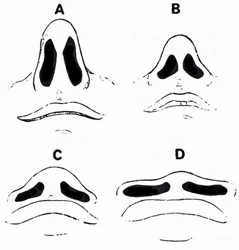 Форма ноздрей. Типы носа. Контур ноздрей.