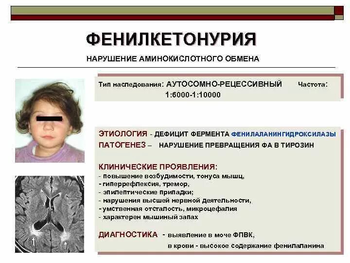 Тип наследования фенилкетонурии. Фенилкетонурия аутосомно-рецессивный. фенилкетонурия хромосомная карта. фенилкетонурия тип наследования.