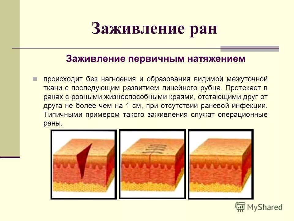 Виды повреждений ткани