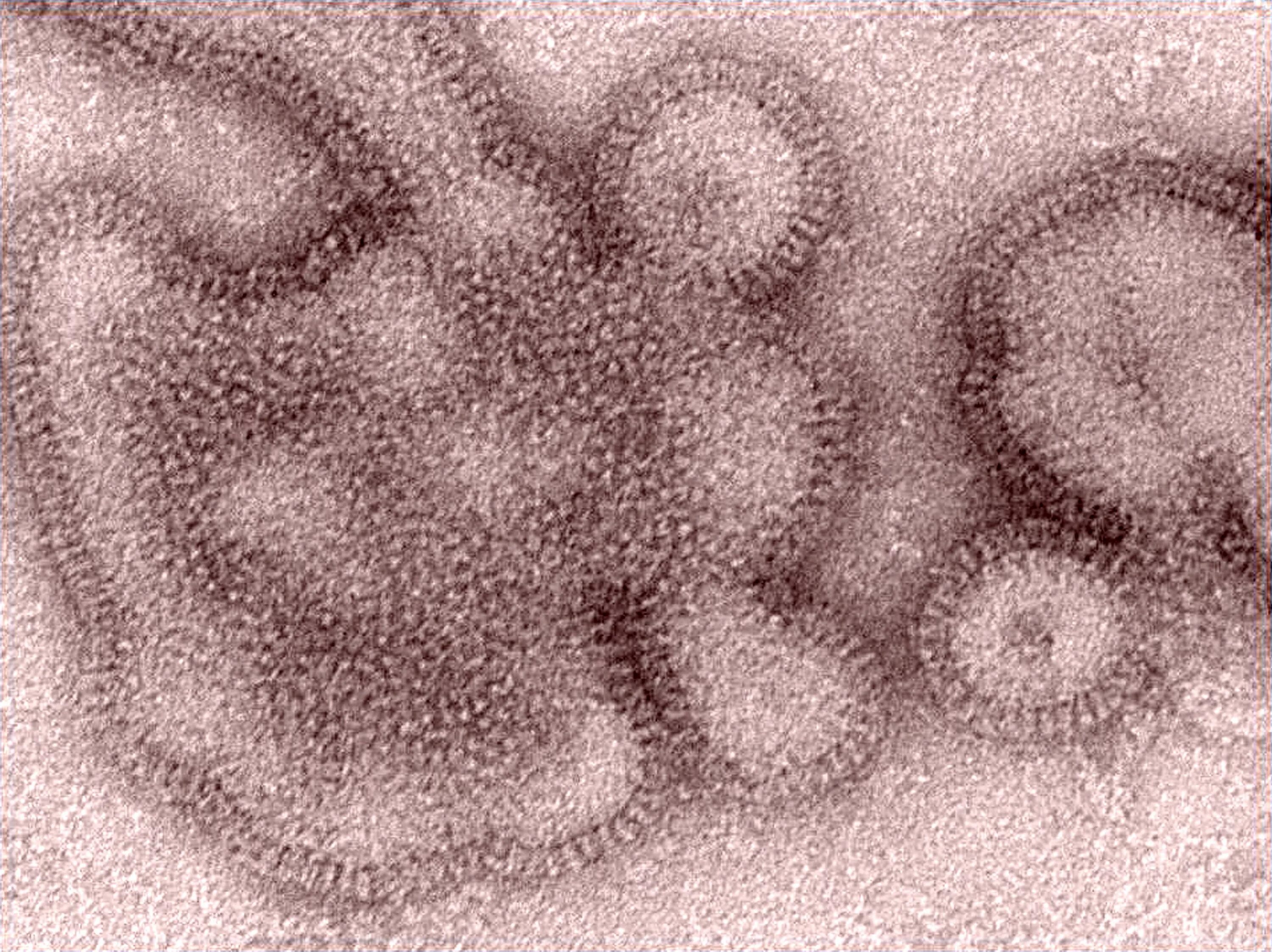 Вирус гриппа под. Вирус h3n2. Вирус гриппа h3n2. Вирус h1n1 испанка под микроскопом. H3n2 гонконгский грипп.