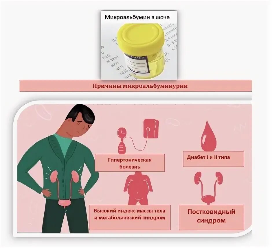 Микроальбумин в моче повышен у мужчин. Анализ мочи на микроальбуминурию. Тест на микроальбуминурию. Микроальбуминурия как сдавать. Альбумин в крови лабораторный.