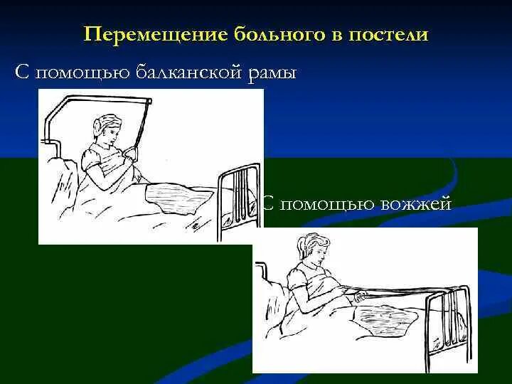 При поступлении тяжелобольного пациента. Перемещение больного в постели. Перемещение тяжелобольного пациента в постели. Перемещение тяжелобольного в постели алгоритм. Перемещение пациента в кровати алгоритм.