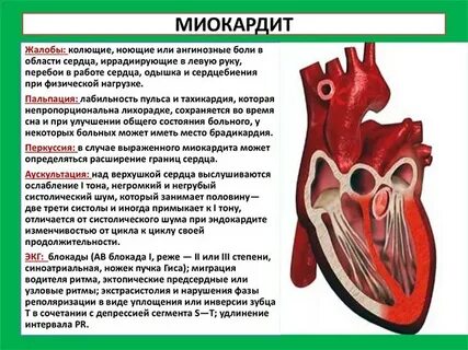 Миокардит что это