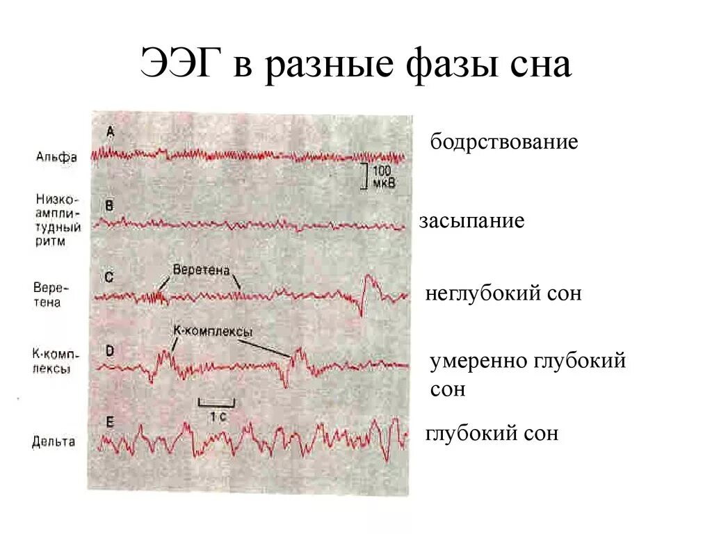 Ээг работа. Фазы сна физиология электроэнцефалограмма. Структура (фазы) физиологического сна. ЭЭГ-корреляты фаз сна.. Фаза быстрого сна ЭЭГ. Ритмы ЭЭГ И фазы сна.