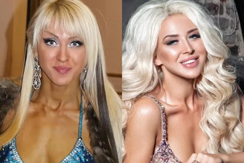 Стрелец до пластики фото Фотографии СТРЕЛЕЦ ДО ПЛАСТИКИ