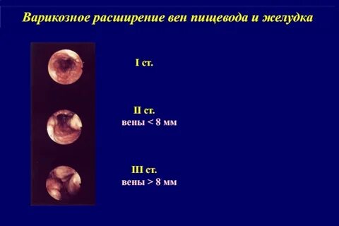 Расширение 1 степени
