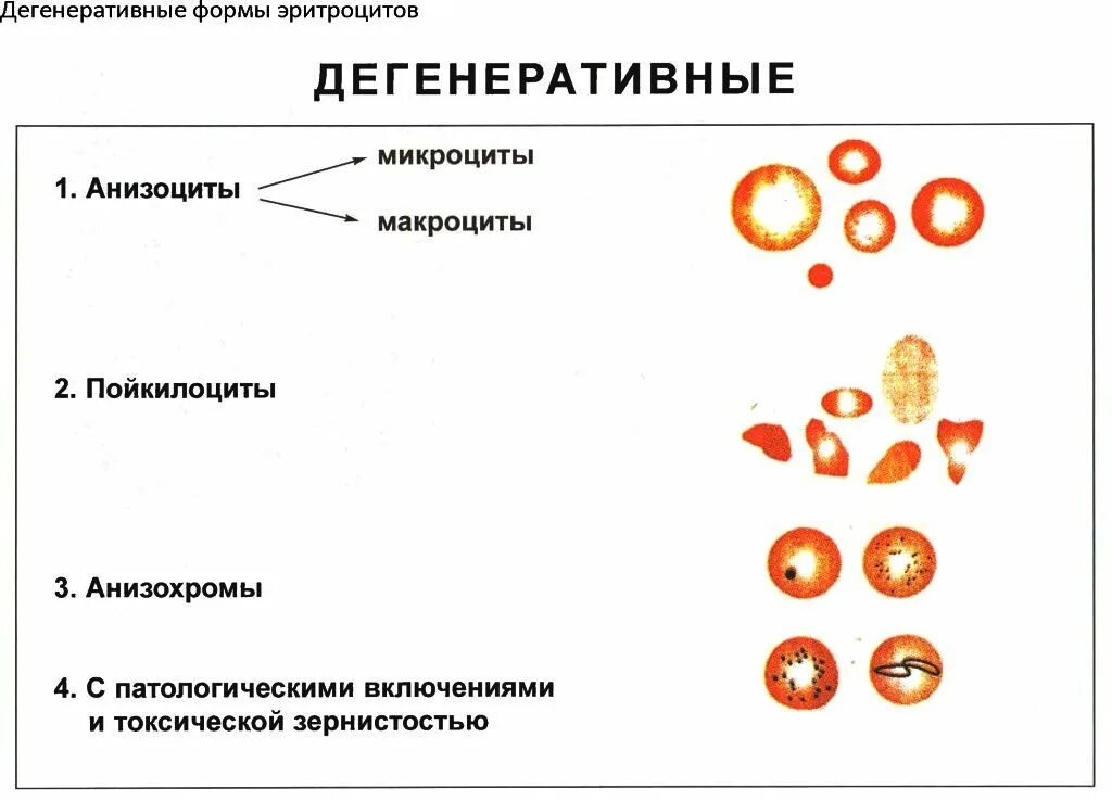 Патологические формы эритроцитов. Регенеративные формы эритроцитов. регенераторные формы эритроцитов это. дегенеративные формы эритроцитов при анемиях. характеристика дегенеративных форм эритроцитов..
